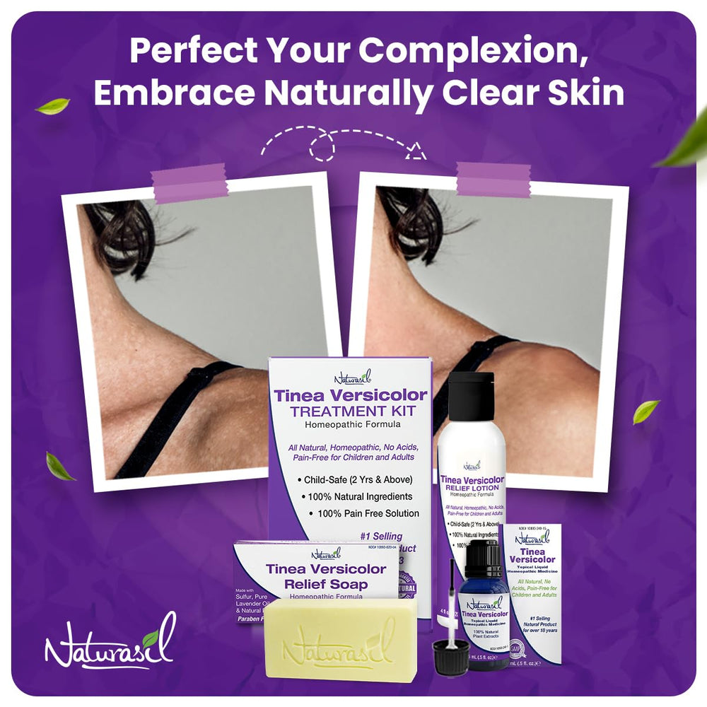 Naturasil Tinea Versicolor Kit packaging detail with label information.