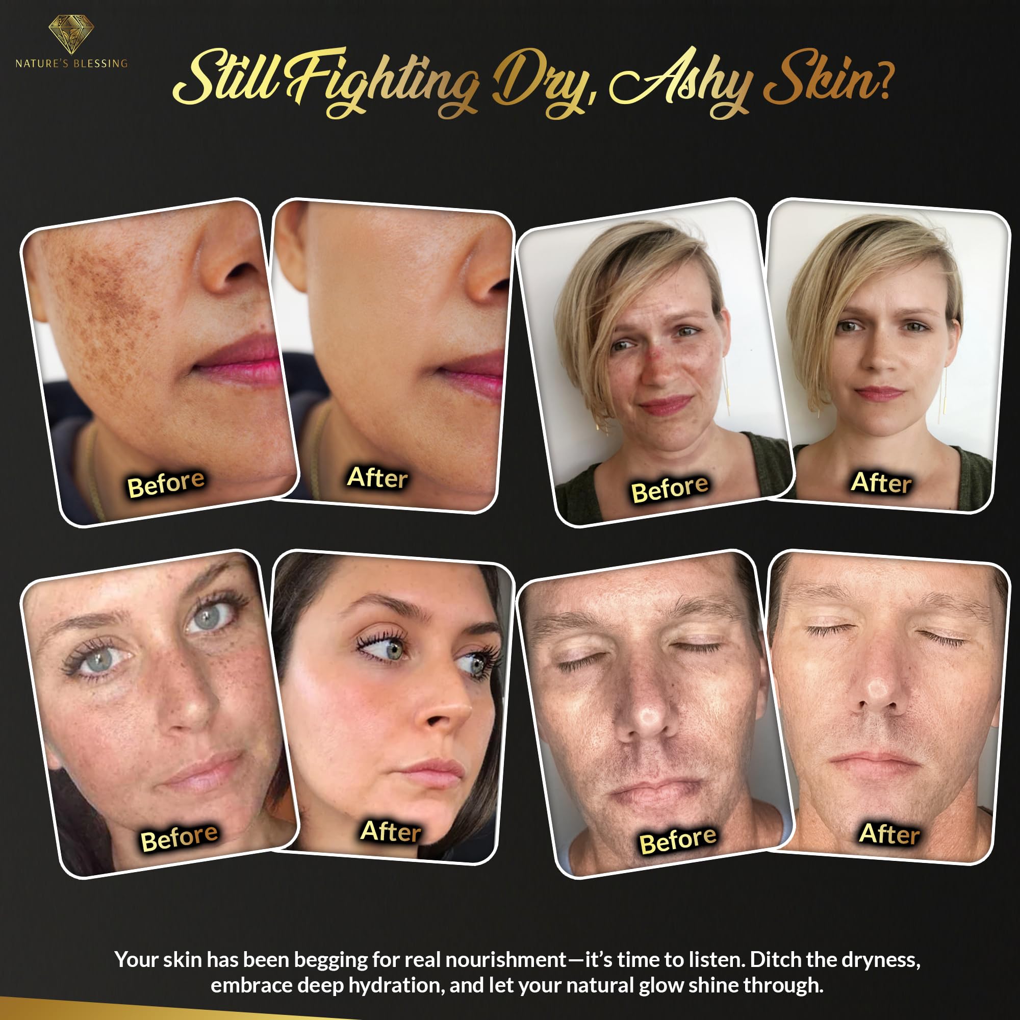 Nature's Blessing vitamin-rich formula supports skin elasticity