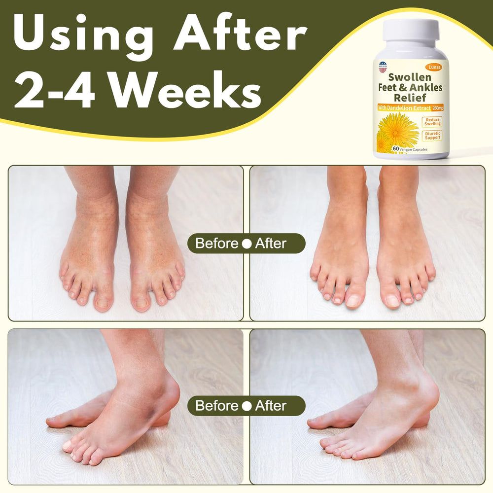 Netrca dandelion leaf extract ingredient highlighting natural fluid balance support