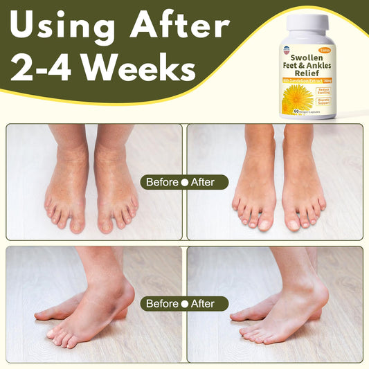 Netrca dandelion leaf extract ingredient highlighting natural fluid balance support