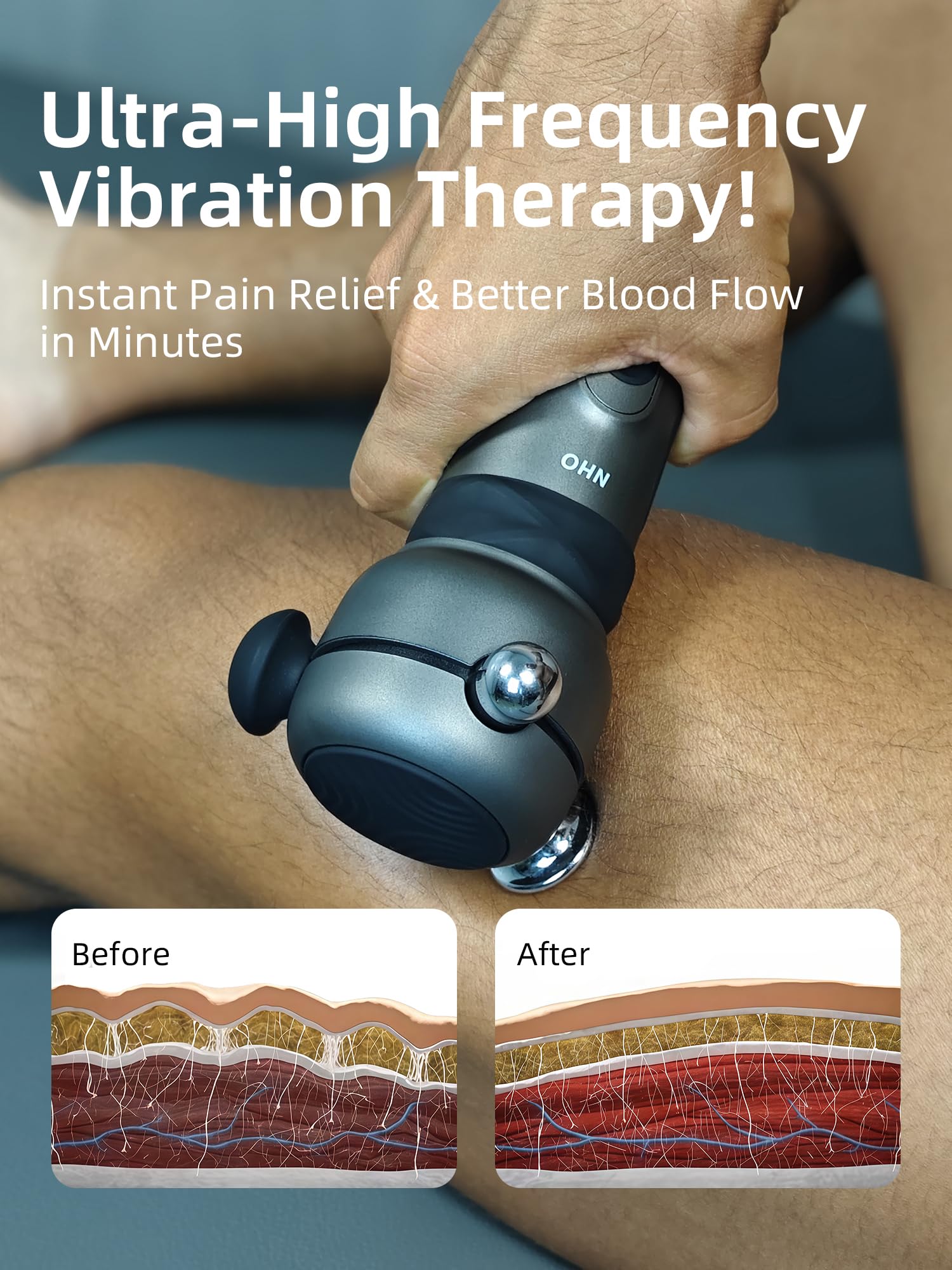 NHO Massage Gun targeting tendons for release