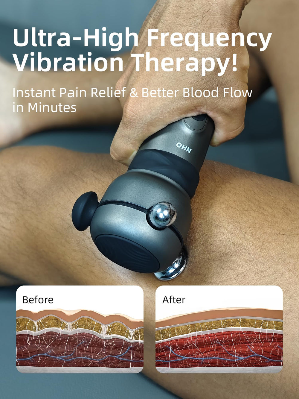 NHO Massage Gun targeting tendons for release