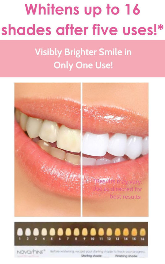 Novashine concentrated peroxide gel tube ready for quick, effective whitening