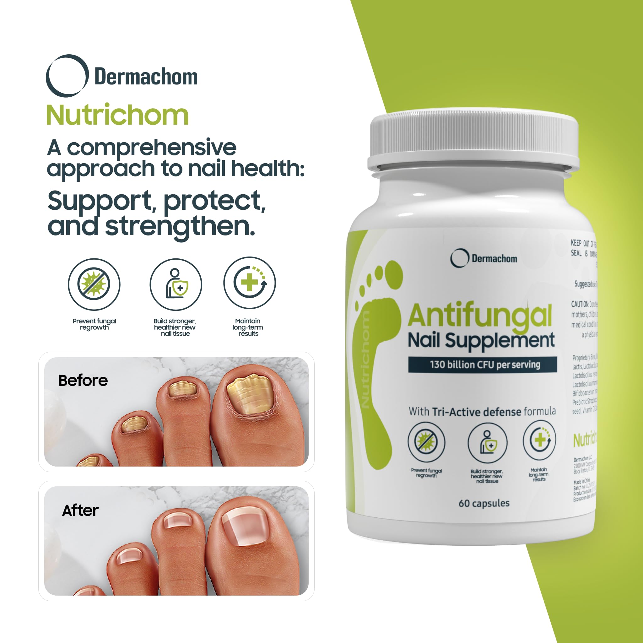 Nutrichom capsules poured show two-capsule daily plan.