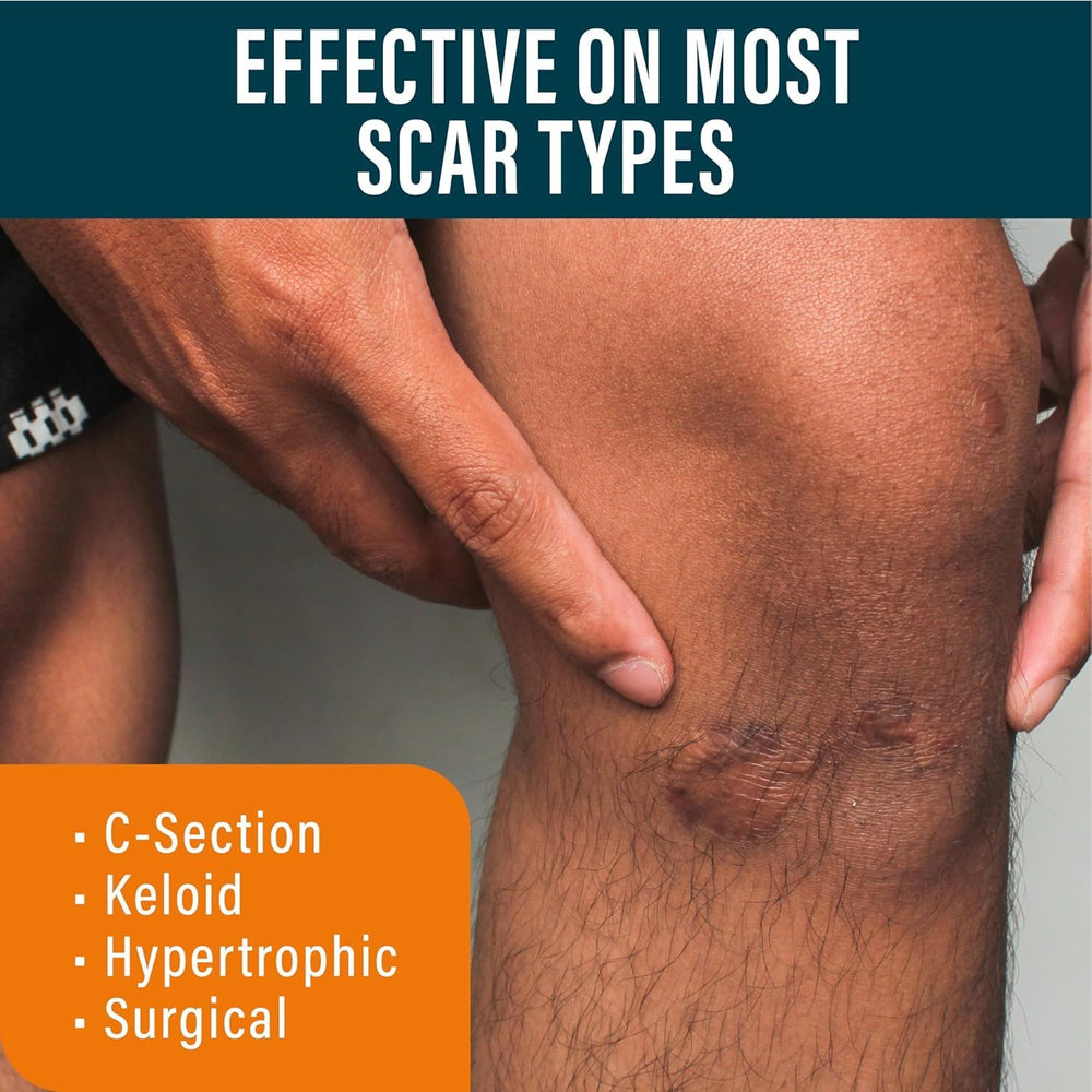 NUVADERMIS dual-action routine guide demonstrates applying gel then tape to support healing