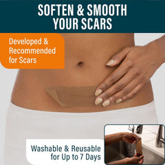 NUVADERMIS silicone scar tape on abdominal area after C-section illustrates discreet, 24-hour wear