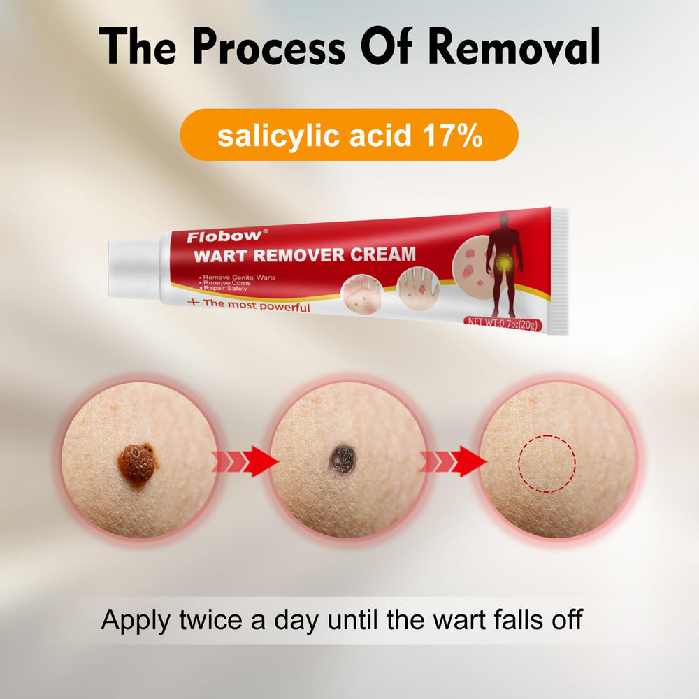 Applying OJIOG gel directly to the wart for targeted treatment