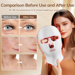 ONLUKY USB-C rechargeable red light therapy mask for easy charging.