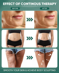 ONUEMP cellulite removal massage tool aids texture smoothing with regular use.