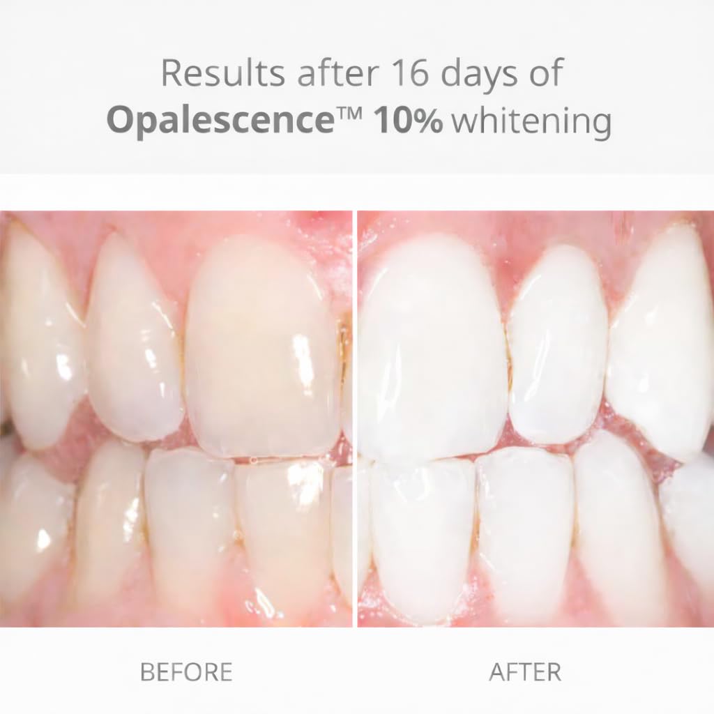 Opalescence melon-flavor gel close-up designed for comfortable whitening