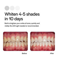 Detail of Opalescence Go 15% Mint gel in the tray for whitening formula