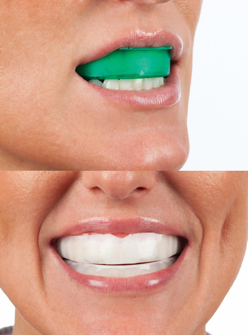Opalescence Go four-treatment pack label communicates value.