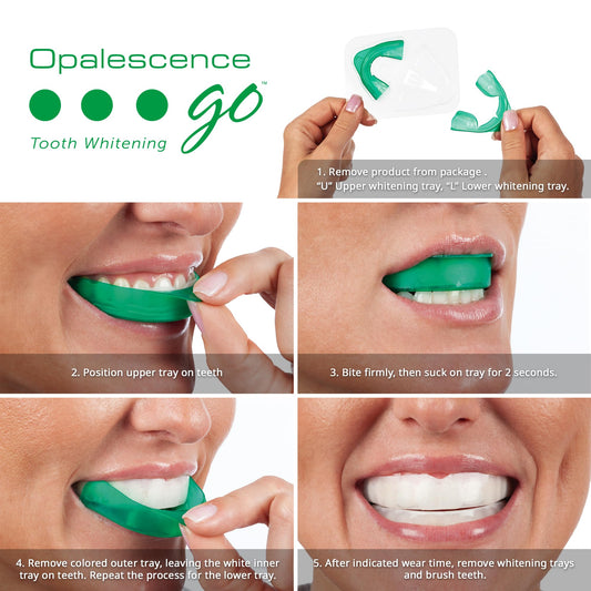Opalescence Go trays closeup with gel for easy whitening sessions.