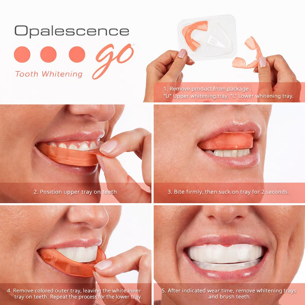 Opalescence Go UltraFit tray conforming to a smile for comfort.