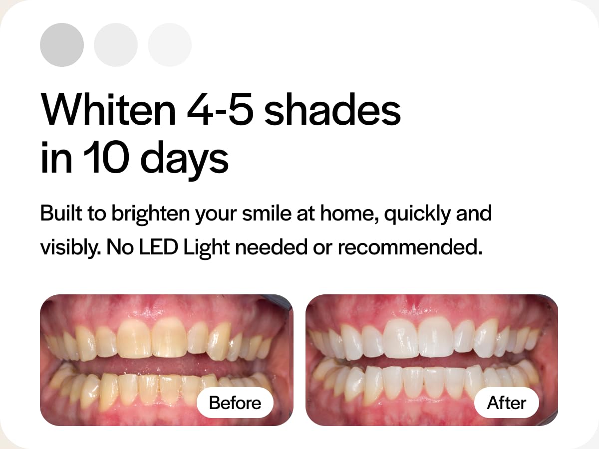 Low-sensitivity Opalescence formula designed to minimize discomfort during whitening.