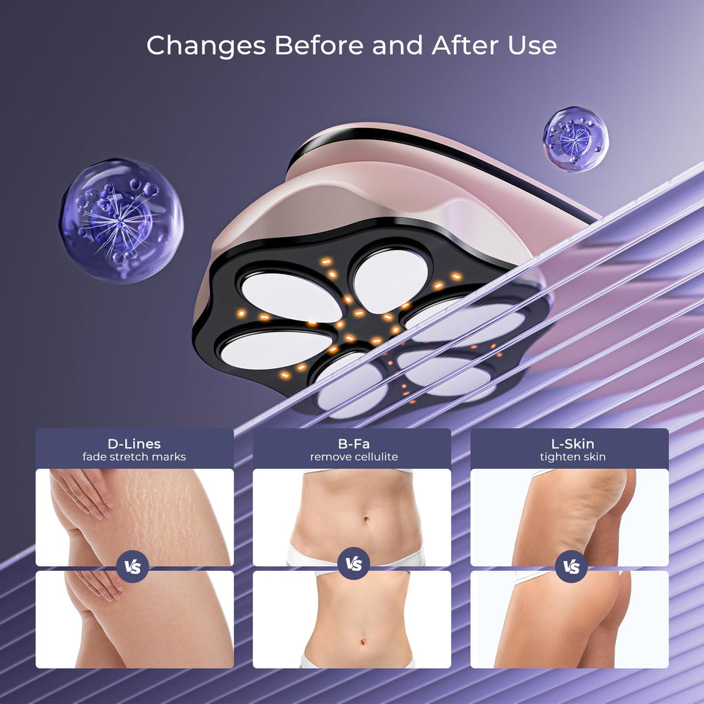 Oranmagic Pro Massager buttocks toning helps smooth skin in targeted areas.