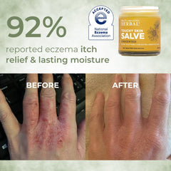 Touchy Skin Salve travel size packaging convenient for on-the-go care by Ora's Amazing Herbal.