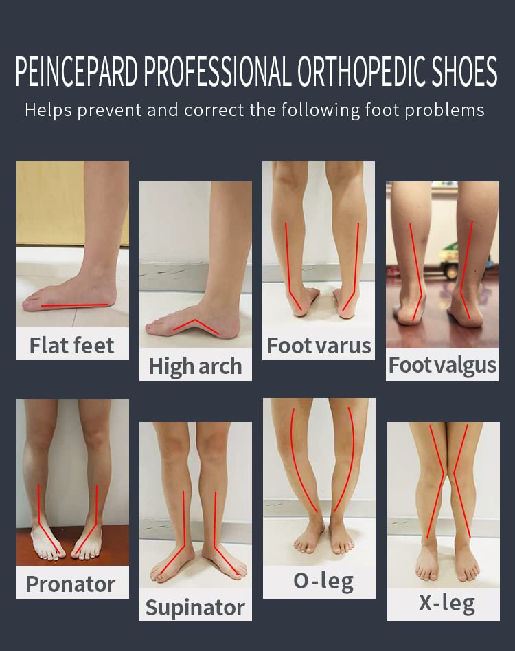 Orthopop ankle-support sneakers stabilize ankles during active play for confident movement.