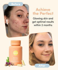 Hands hold Ovira Skin Clear bottle for on-the-go skin support