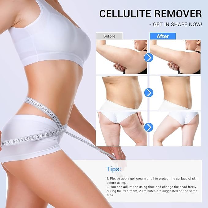 PAIM NRE cellulite massager with multiple settings for personalized comfort