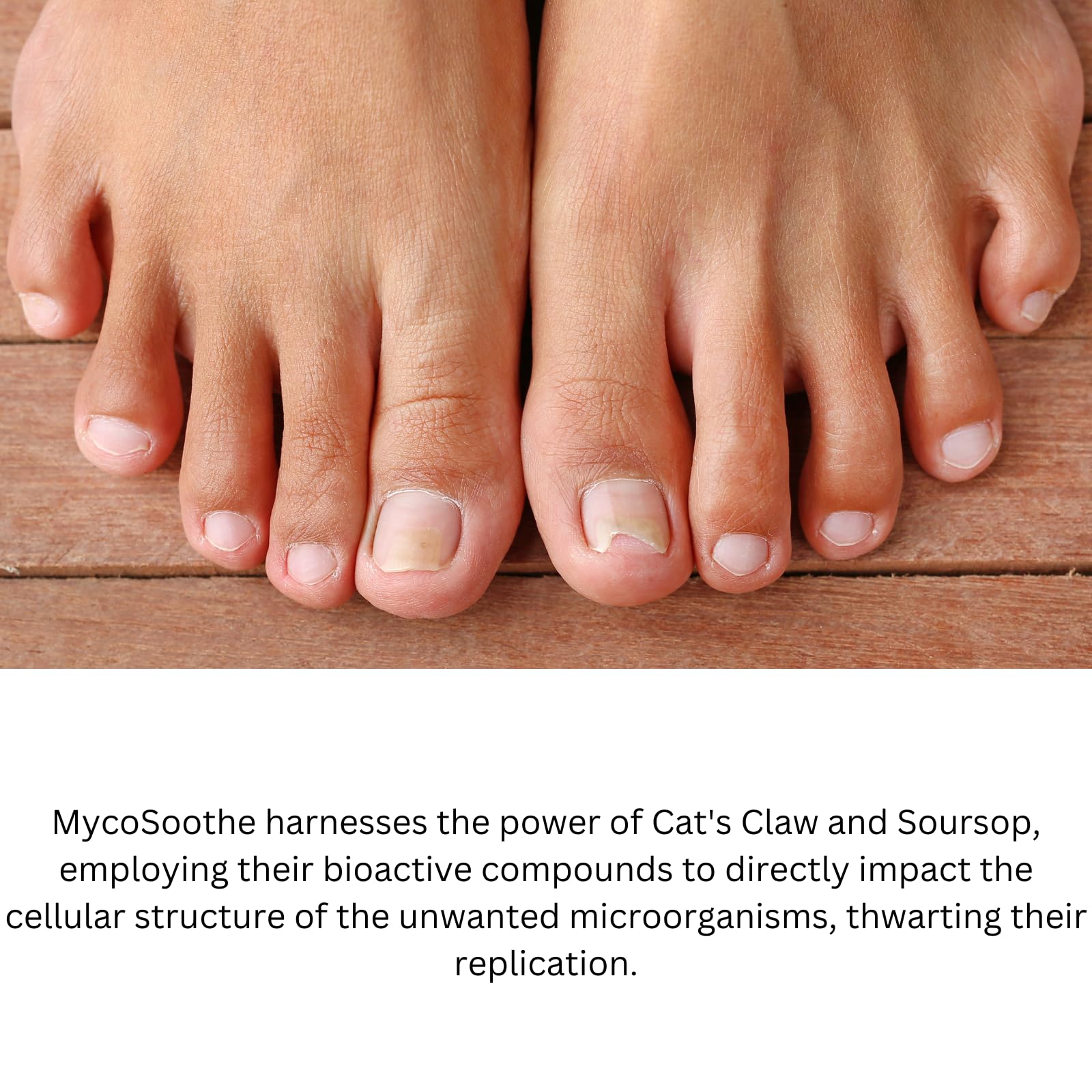 Phytage Labs MycoSoothe yellow-nail contrast hints at potential improvements.