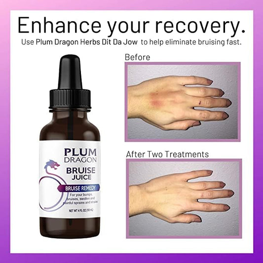 Plum Dragon Bruise Juice dropper cap for precise, convenient topical dosing.
