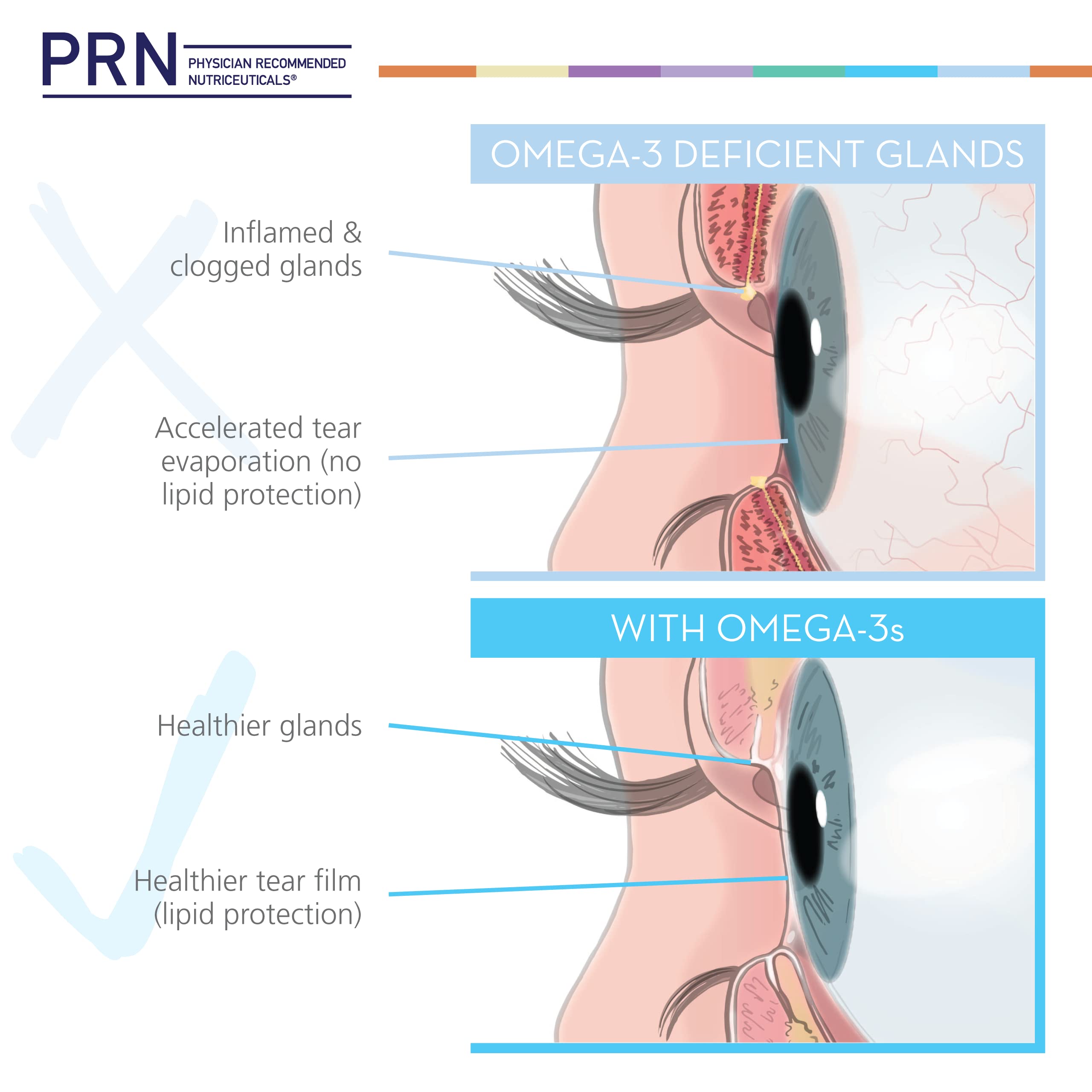 Spoon-dose of PRN DE Omega presented as a simple daily ritual.