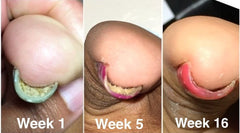 Probelle Three-pack packaging for convenient ongoing nail care.