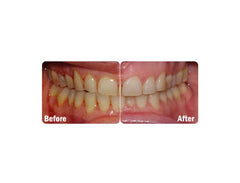 Probiora Kids fresh breath benefits shown by product imagery.