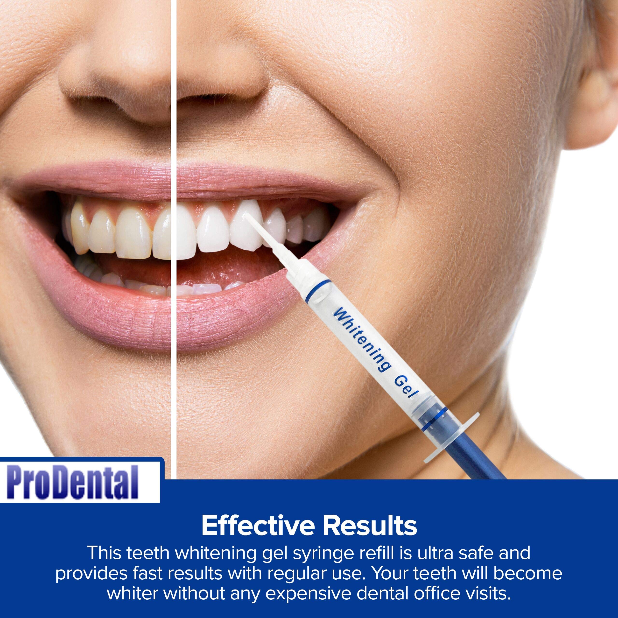 Prodental syringe application close-up showing controlled gel placement on teeth.