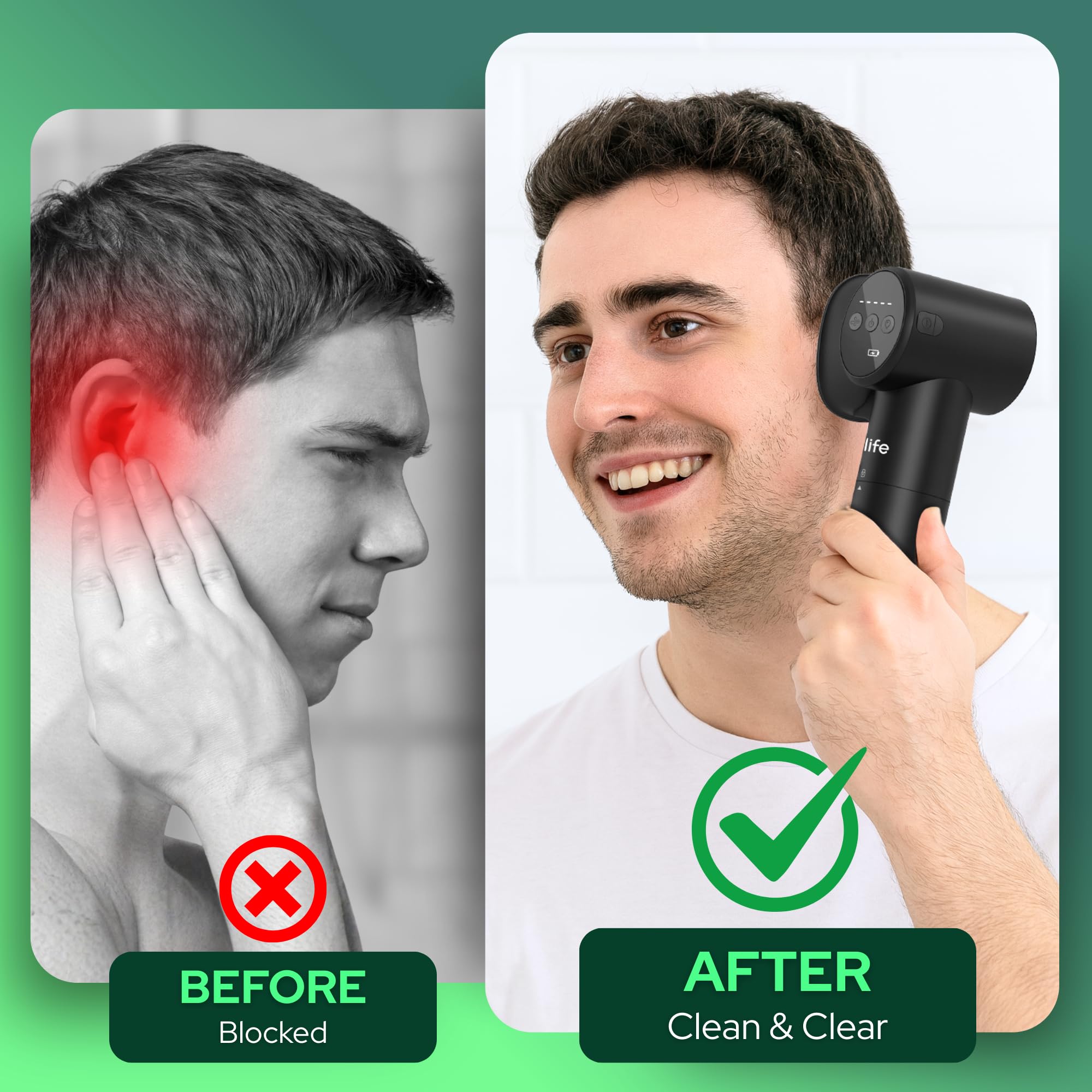 PROOLIFE dual-tank system used in hygienic ear flushing process.