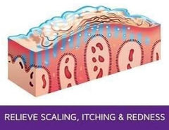 Prosoria Ointment Tube Packaging emphasizes compact, travel-friendly design.