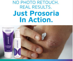 Prosoria treatment system packaging design shot emphasizing compact kit.