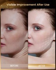PrunGo LED mask open nose area for easier breathing.