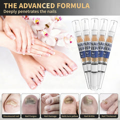 PUPCA toe spacers-in-use illustrate comfortable daily nail care.