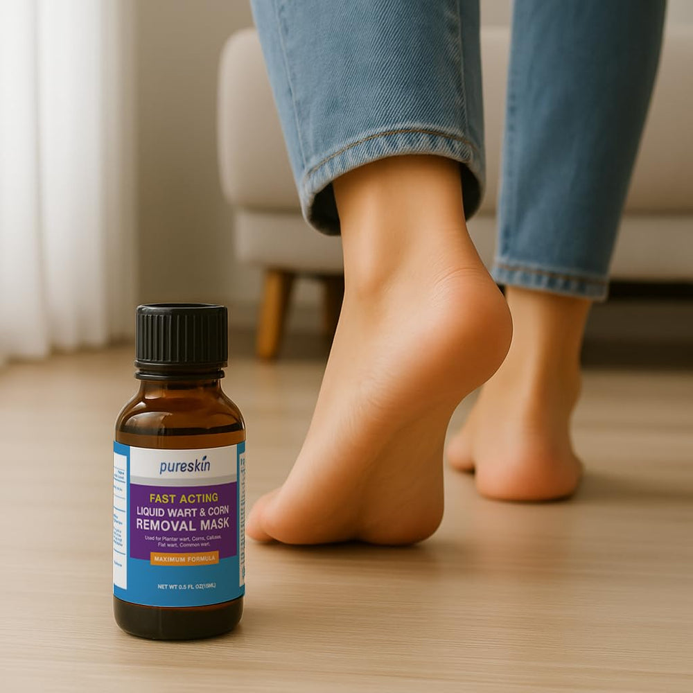PURESKIN wart remover in use on a foot wart for at‑home care.