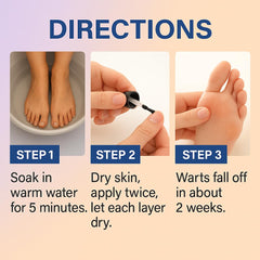 PURESKIN two‑bottle wart remover set ready for home use.