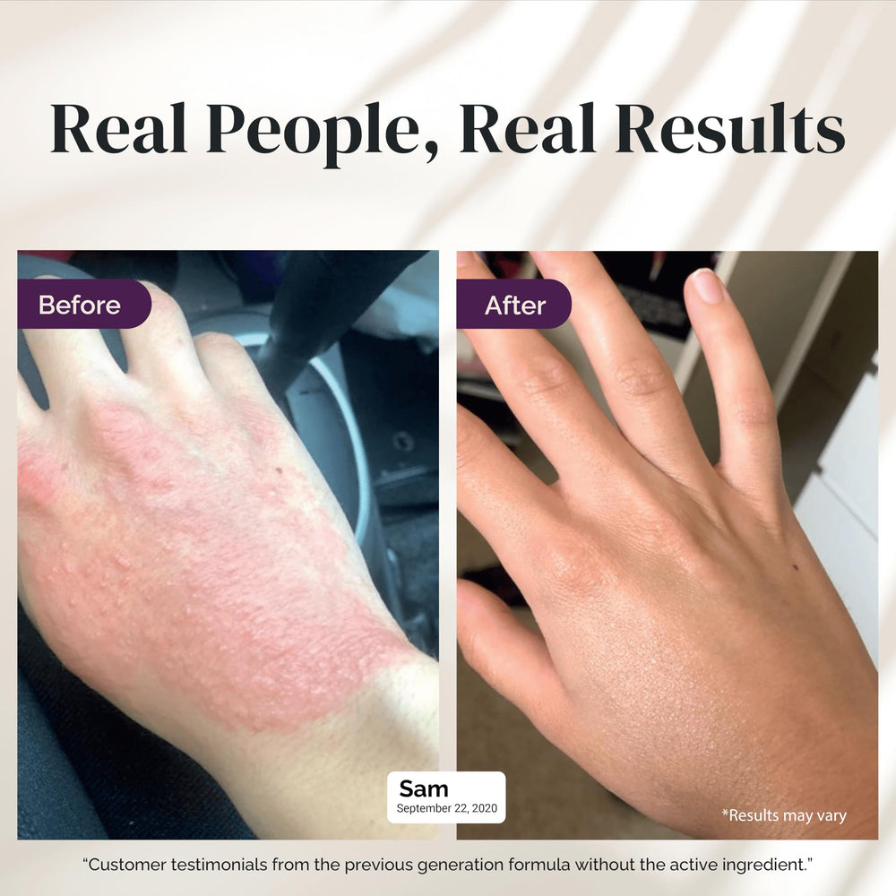 Puriya eczema cream for kids used daily in a bathroom setting