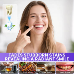 Purple Teeth Whitening Strips compact design for simple use