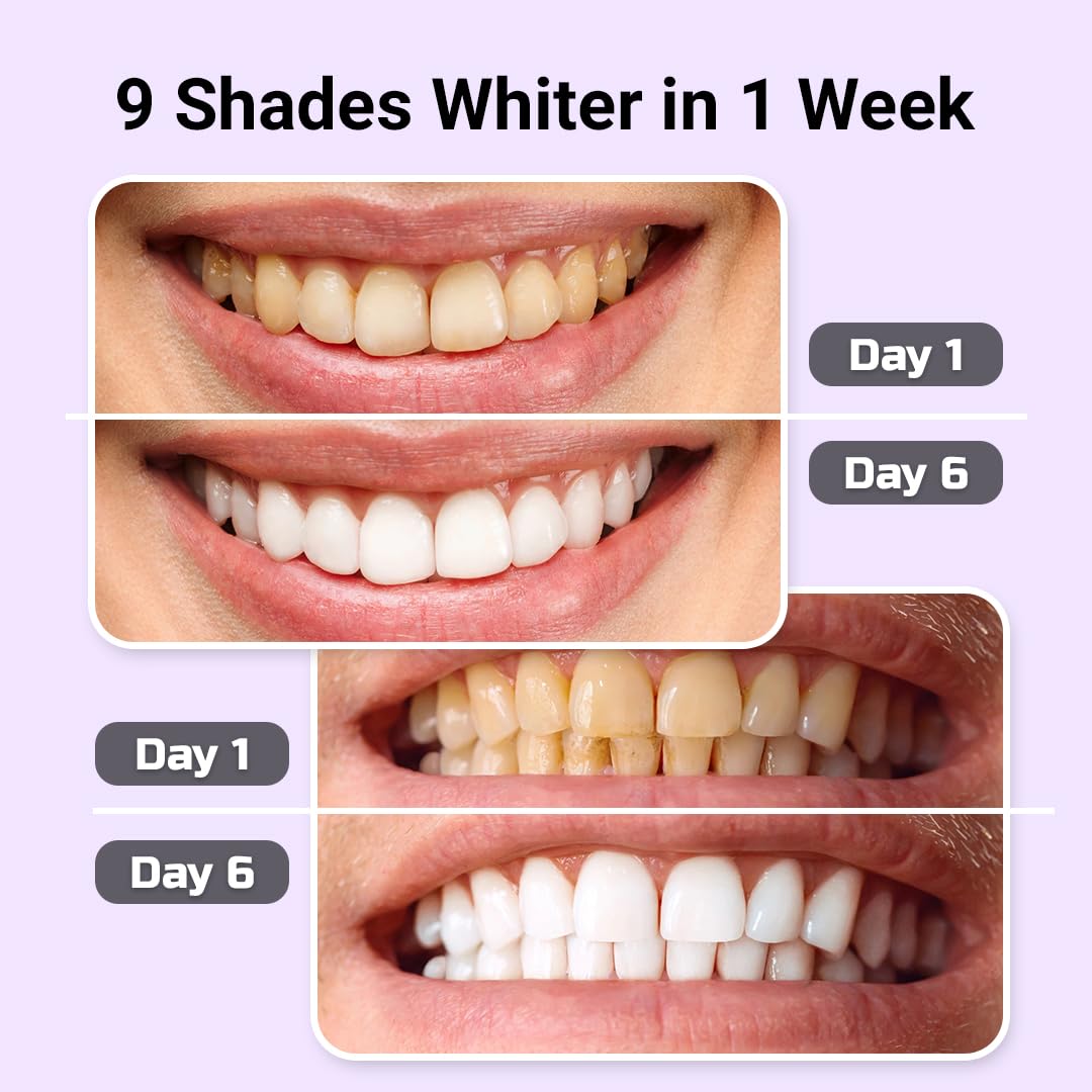 Puur Smile helps reduce coffee stains with routine use