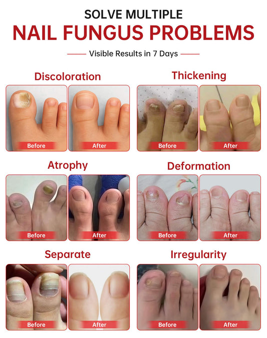 QQE dropper enables precise application on nails.