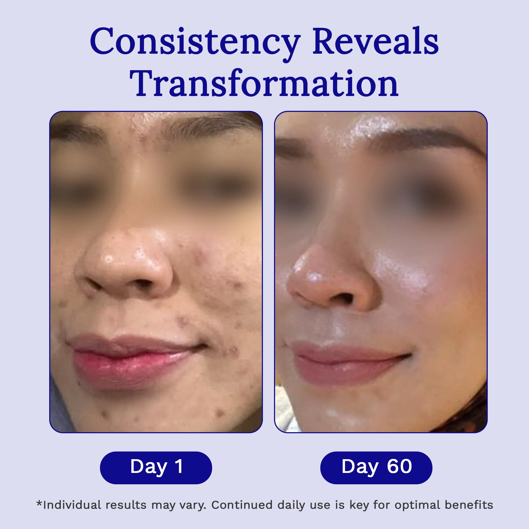 Fast-drying RejuvaSil gel with water-resistant properties.