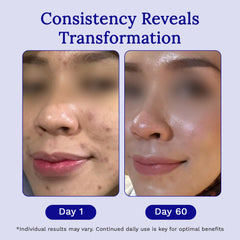Fast-drying RejuvaSil gel with water-resistant properties.