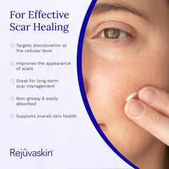 RejuvaSil gel on acne scar area to improve texture and tone