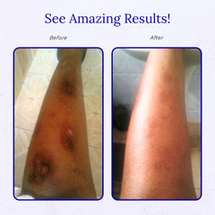 Translucent, non greasy RejuvaSil formula on skin during use
