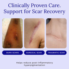 Rejuvaskin Scar Esthetique application massage demonstrates circular motion for pliability