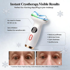 RFVDC cold therapy mode cooling surface to refresh and depuff.