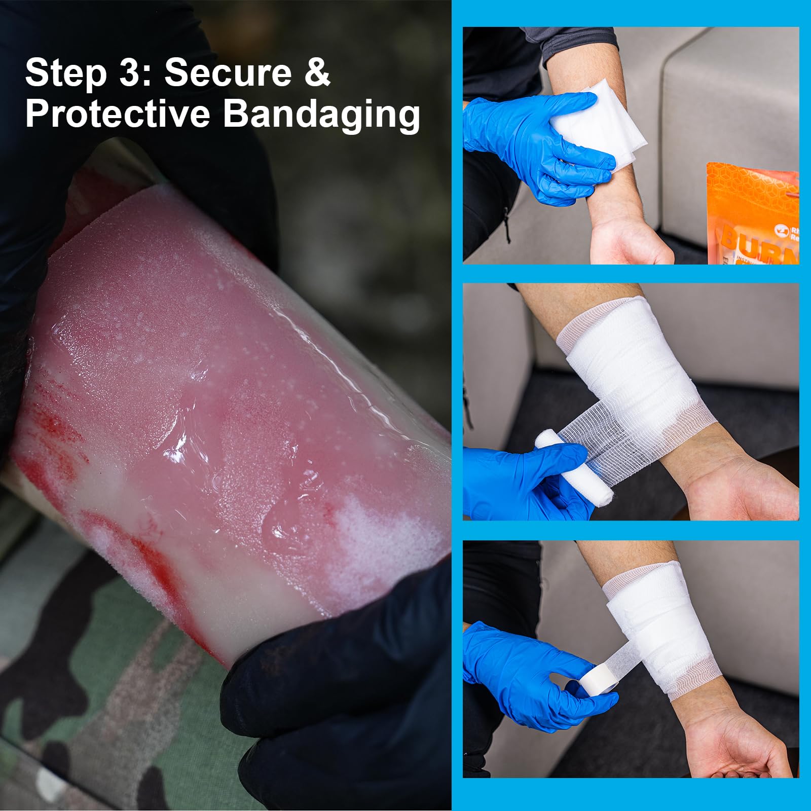 Rhino Rescue scissors, nitrile gloves, and tape for safe dressing.