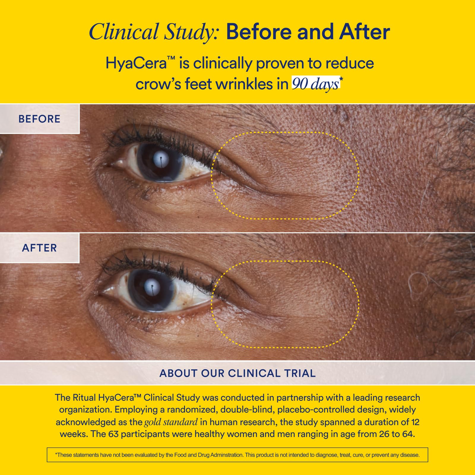 Ritual HyaCera traceable supply chain graphic illustrating transparency and quality control.