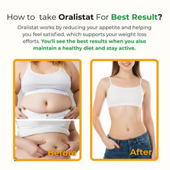Rivocoda Oralistat capsules close-up showing soft gel capsules for cravings management